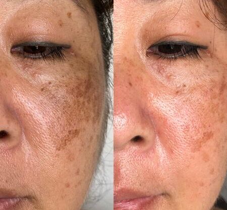 Dark spot